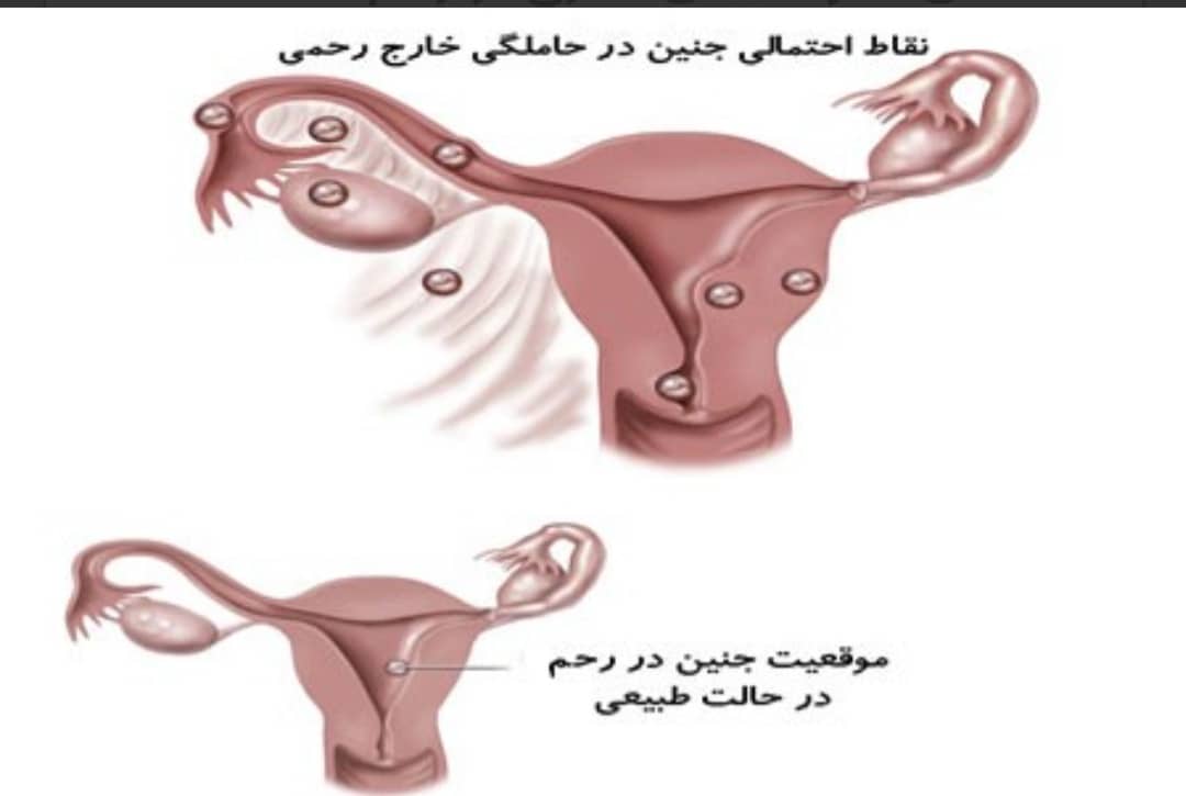 danestani